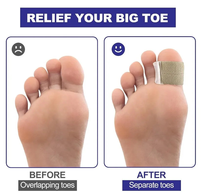 DIGELYA - Gel Toe Spacers for Comfortable Bunion Alignment