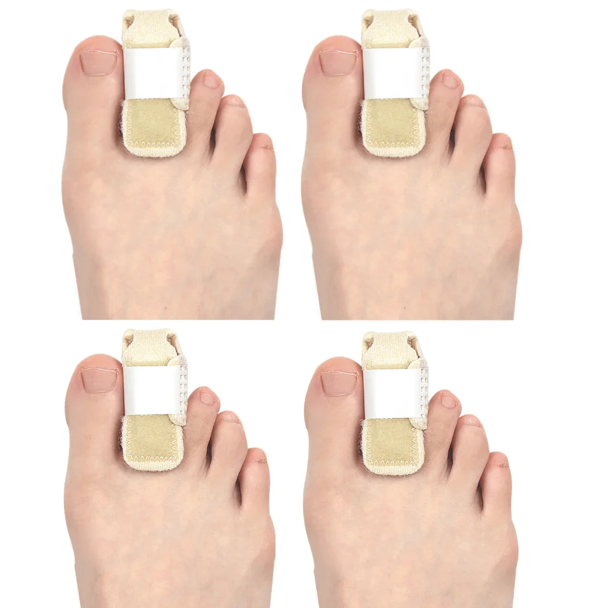 ALIGVIA - Adjustable Toe Splint for Cushioned Alignment Support