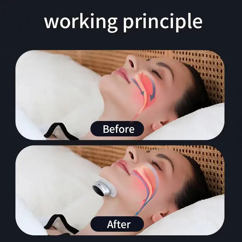NAREVIO - Electric Anti-Snoring Device for Quieter Sleep