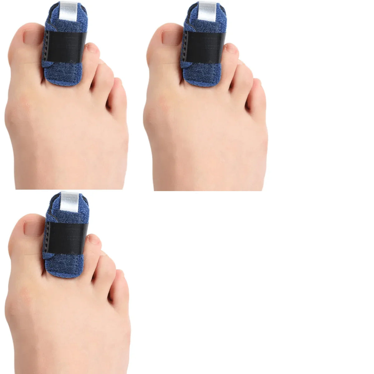 ALIGVIA - Adjustable Toe Splint for Cushioned Alignment Support